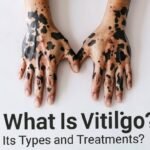Vitilinox